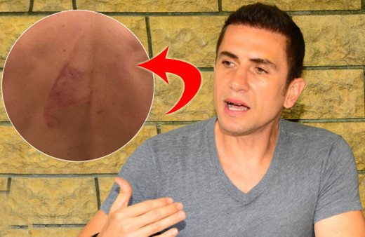 15 kişi üstüne çullanmış! Emre Aşık isyan bayrağını çekti