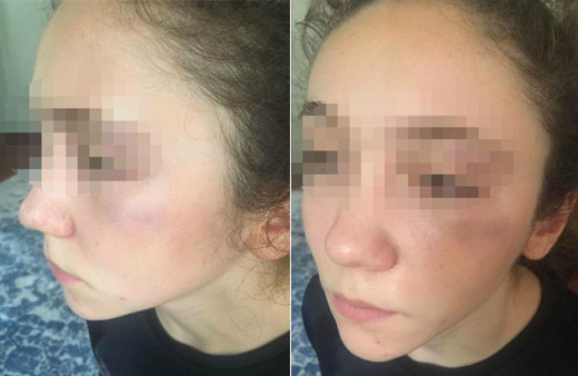 'Antrenör, 14 yaşındaki milli karateciyi yumrukla dövdü' iddiası