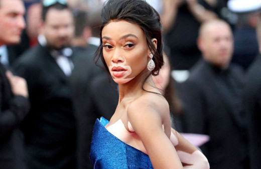 Sıradışı görüntüsüyle dikkat çekmişti! Winnie Harlow artık bir melek