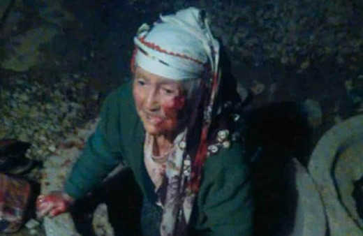 Üstü açık bırakılan rögara düşen yaşlı kadın yaralandı