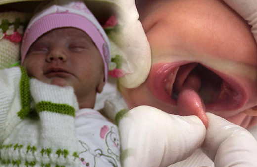 Dünyada nadir görülüyor çift dille doğan bebek ailesine şoku yaşattı