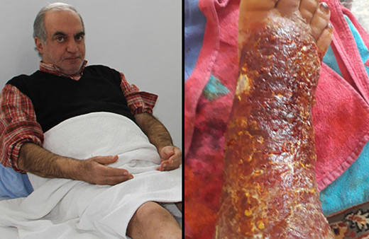 Yaralar içindeki bacağı kesilmek üzereydi! Bu yöntemle tamamen iyileşti