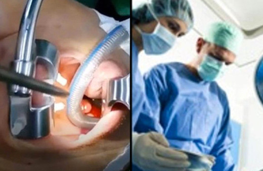 Migren için ameliyata girdi! Ağzından çıkan şey ise korkunç