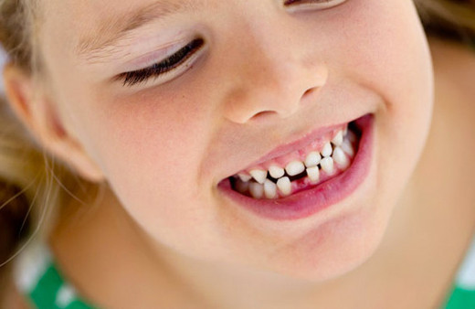 Diş çürüklerini tedavi etmek için lazer uygulaması faydalı olur mu?