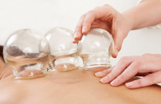 Hacamat günleri hangisi Ocak ayında hangi gün yaptırılmaz? 