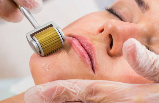 Cildi genç tutma yöntemlerinden mezoterapi nedir?