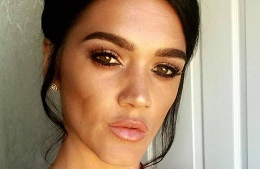 Türkiye'de kalça ameliyatı olan kadının ölüm nedeni belli oldu