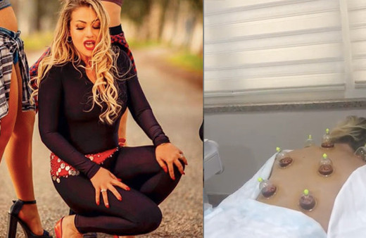 Yeliz Yeşilmen'in yarı çıplak hacamat videosu olay! Kuran okunurken...