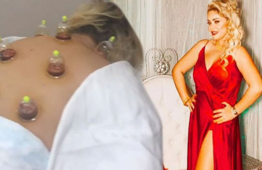 Yeliz Yeşilmen hacamat videosu olay oldu yorumlara kapattı