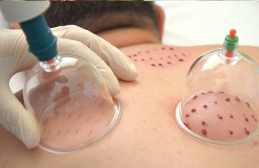 Hacamat günleri 2018 ne zaman yaptırılır takvimi