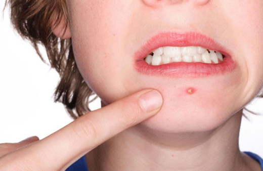 Sivilcenizi sakın bir daha sıkmayın! Sonuçları çok ağır olabilir