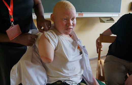 Tanzanya'da büyü vahşeti 6 çocuğu acımadan parçaladılar