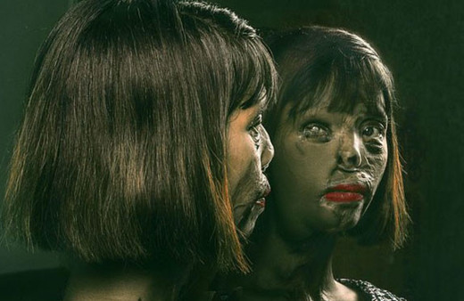 Annesi öldürüldü kendi asit saldırısına uğradı! Nedeni ise...