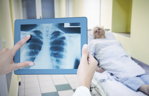 KOAH hastalarına nefes aldıran yöntem