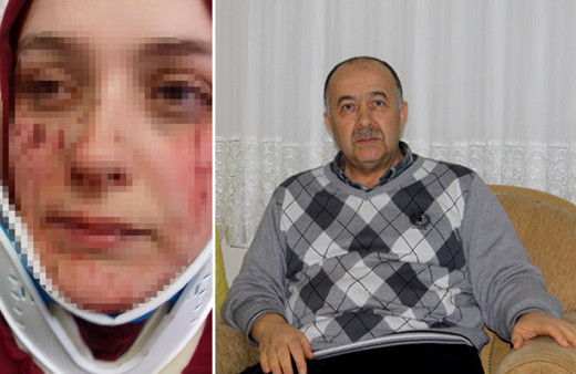 Eşi tarafından bardakla yüzü kesildi! Az daha kör oluyordu