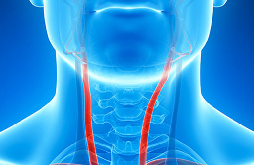 Şah damar tıkanıklığı nedir tedavisi var mıdır?