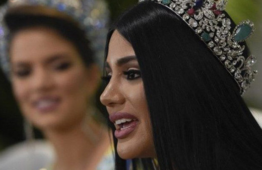 Venezuela Güzeli estetikli çıktı! Doktorundan bomba açıklama