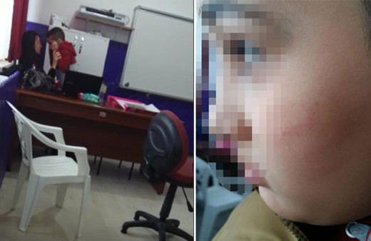 Cani öğretmen! Otizmli çocuğu dövüp morlukları da böyle kapatmış