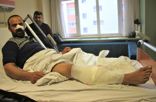 Korkunç olay: Burnunu ve bacağını parçaladılar!