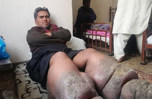 Görenleri dehşete düşüren görüntü! Bir enfeksiyon hayatını karartı