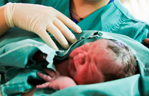 Doğumu ebeler mi yapar doktorlar mı? 