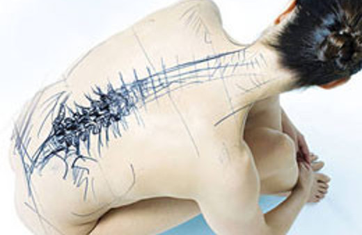 350 bin kişide bu hastalık var