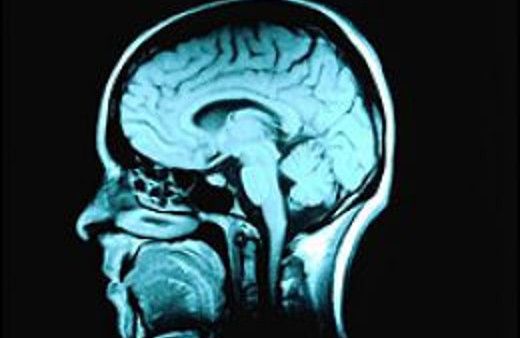 Alzheimer hastalarına umut uşığı