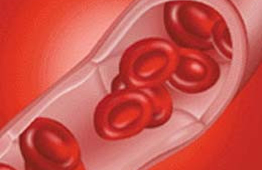 Sizde de bu belirtiler var mı?