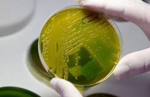 Batı Nil virüsü alarmı!