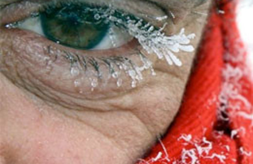 Meteoroloji'den acil uyarı