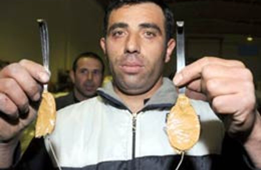 Gözündeki kancayla arabayı çekti