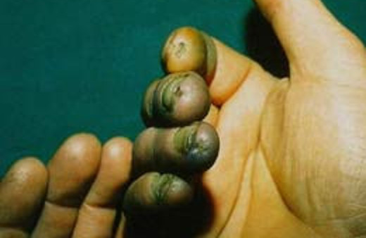 İşçiler bu risklerden haberiniz var mı?