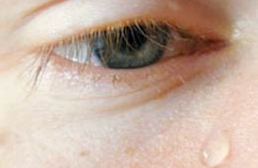 Alerjik göz kabusunuz olmasın!