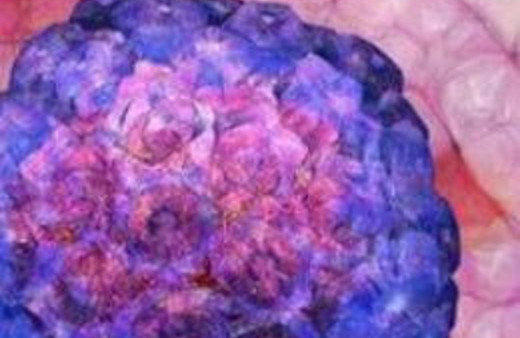 Bu illerde yaşayanlar kansere yakın!