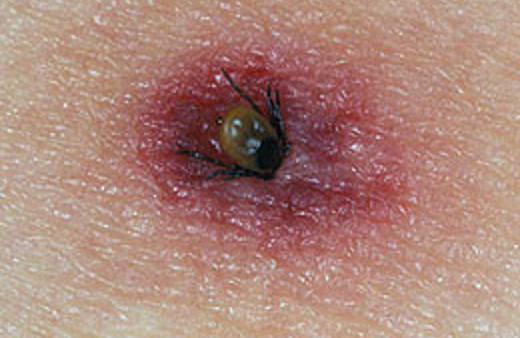 KKKA bulaşan doktor yoğun bakımda!