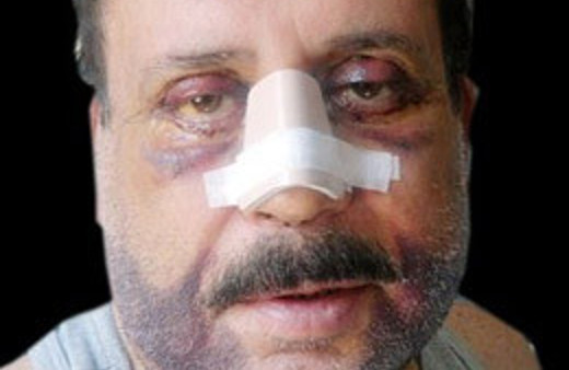 Gökhan Güney'in bu hali dehşete düşürdü