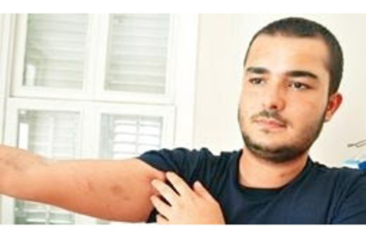 Polislerden gördüğü işkenceyi böyle anlattı