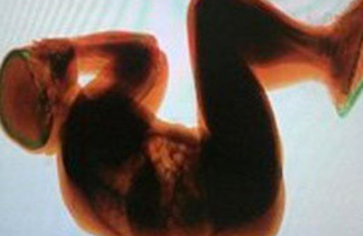 X-ray ekranında şok görüntü