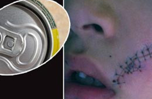 Kola az kalsın yüzünden ediyordu