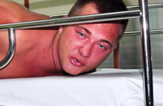 Kelepçeyle tedavi edildi