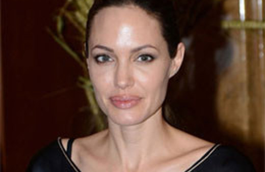 Jolie Türk doktorla görüştü mü?