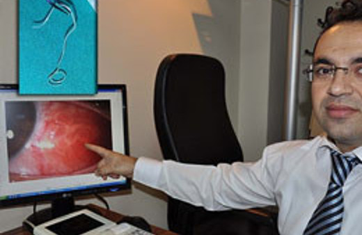 Gözünden 10 cm'lik parazit çıktı