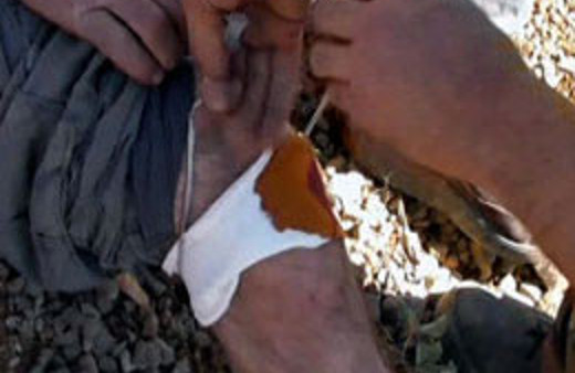 Yaralı teröriste ilk müdahale askerden