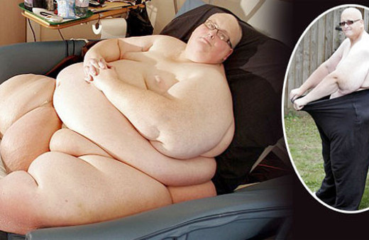 Dünyanın en şişman adamı bu hale geldi