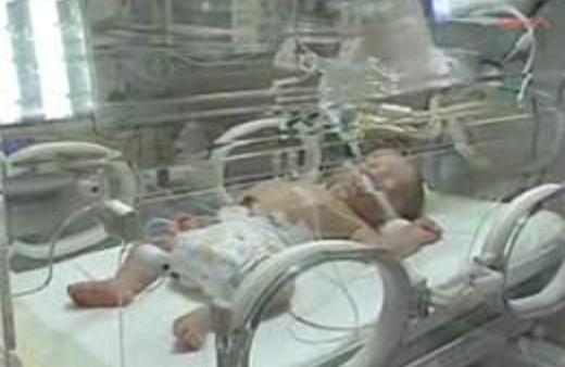 Üç günlük bebeğe anjio