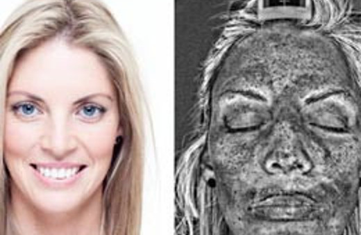 Solaryuma giren bu hale geliyor