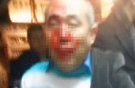 Tacizciye sokak ortasında meydan dayağı