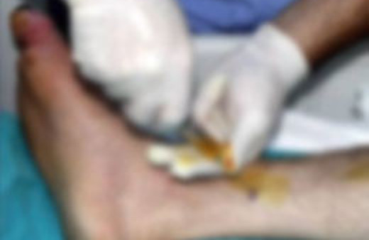 Türk doktorlarından bir ilk daha!