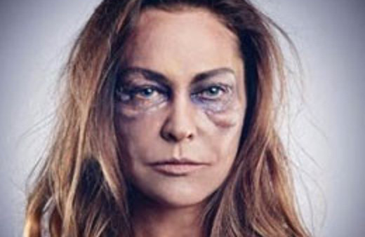 8 ünlü kadın tanınmaz halde!