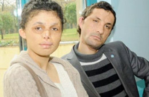 Yüz nakline işte böyle karar verdi!